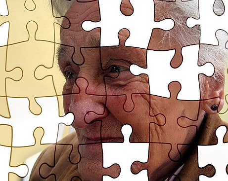 What is Alzheimer's disease